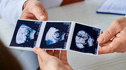 IVF Clinic