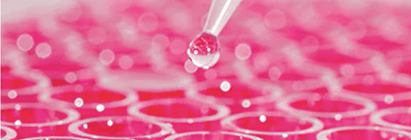 Large-Scale Production of Lentiviral Vectors by Transient Transfection