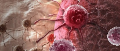 Making Cancer History - CAR T-Cell Therapy